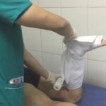Quitar moldura de escayola del techo: consejos y recomendaciones
